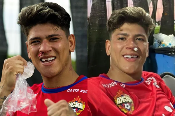 A Jorge Carrascal le dieron un impresionante trancazo mientras jugaba con el CSKA de Moscú.