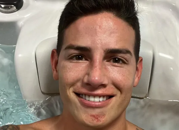 James Rodriguez se está recuperando de una dura lesión que le infligieron en el fútbol de Qatar.