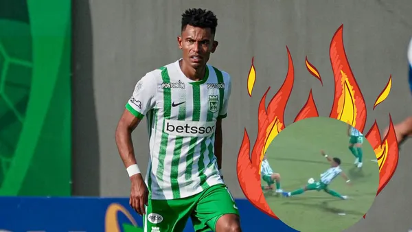 La Regla de la Mano y el Criterio Arbitral