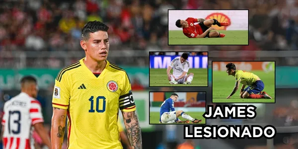Las lesiones de James Rodríguez