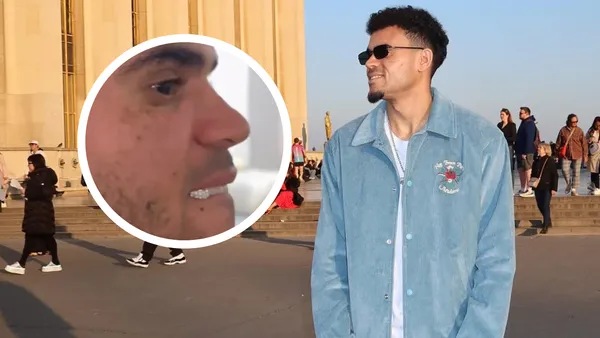 Lucho Díaz: sus dientes de diamante y la millonada que gana. Foto: Luis Díaz y Captura de X