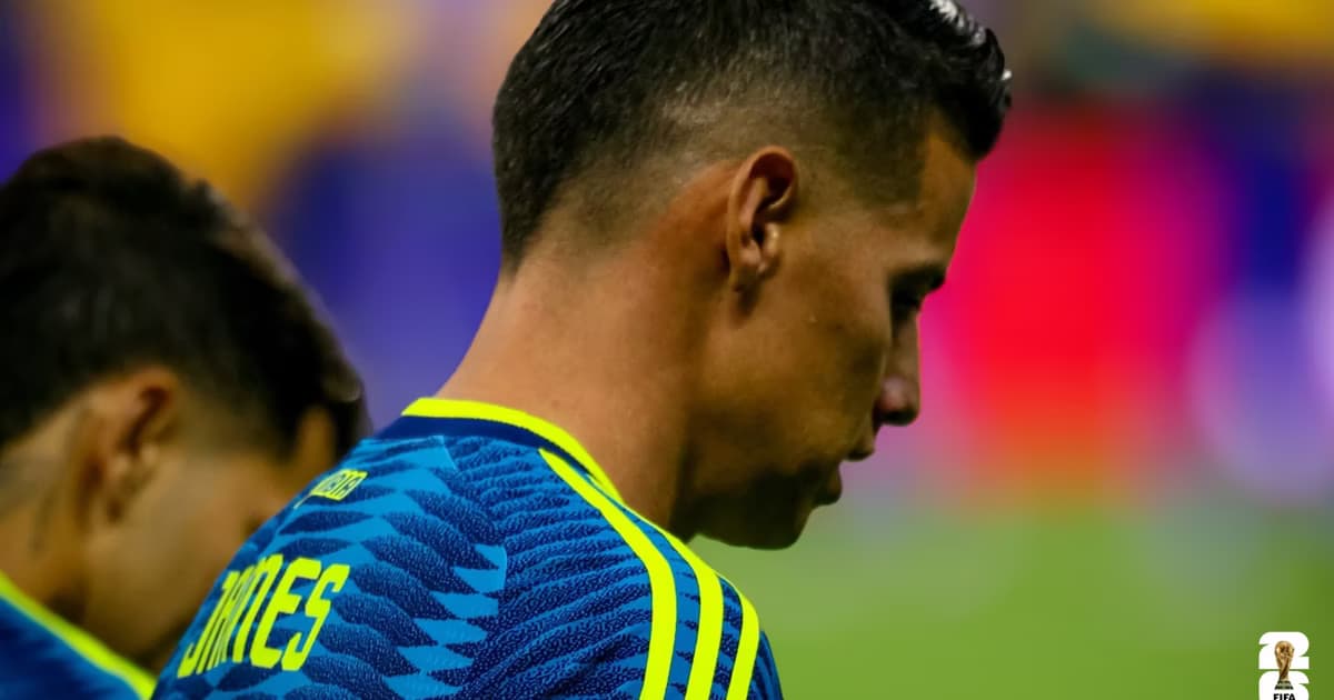Mal partido de James