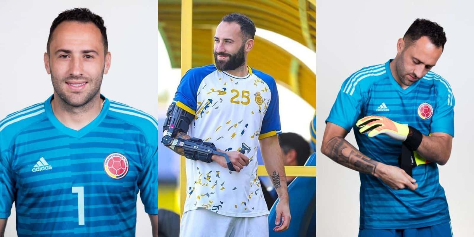 David Ospina está lesionado en el codo y sus seguidores en tono de broma sana le han colocado un nuevo apodo.