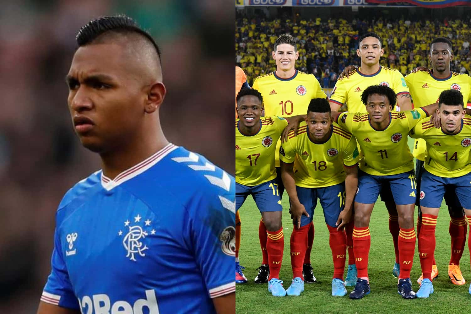 El jugador colombiano se lesionó mientras estaba con la Selección Colombia y ahora se perdería el resto de la temporada.