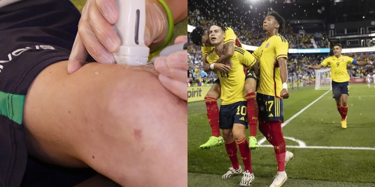 El jugador era una opción para ser llamado a la Selección Colombia y sufrió una terrible lesión que lo dejará afuera por un largo tiempo.
