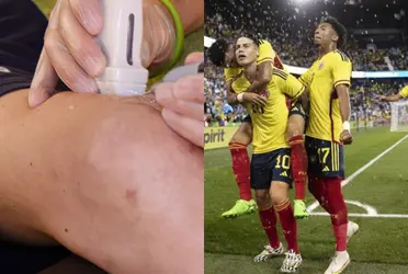 El jugador era una opción para ser llamado a la Selección Colombia y sufrió una terrible lesión que lo dejará afuera por un largo tiempo.